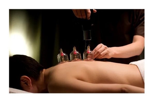 Cupping Therapy - A form of massage therapy which decompresses soft tissue used to treat lack of mobility, tight muscles, scars, headaches, tendonitis, bursitis, planter fasciitis fibromyalgia, and release of trigger points