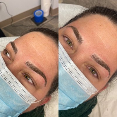 Before and after results - *More Photos in slideshow*