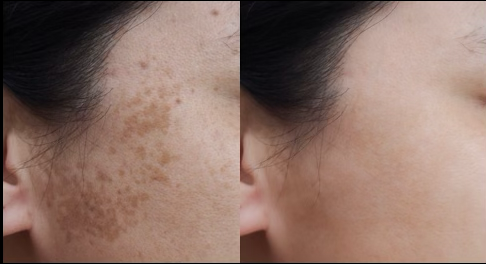 Glowing skin tone and texture - Confidence starts with Clarity laser revealing radiant, even-toned skin with treatments tailored to you, because your skin deserves more than a filter. Glowing skin tone and texture - Confidence starts with Clarity laser revealing radiant, even-toned skin with treatments tailored to you, because your skin deserves more than a filter.