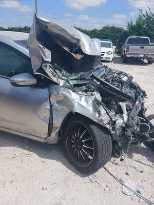 Car Accident Injury Compensation - If you’ve been involved in a car accident, it’s crucial to act quickly to protect your rights and secure the best possible outcome for your situation. AK Law Firm offers a no-obligation, free consultation with a skilled Houston car accident lawyer who can assess the specifics of your case and provide you with clear, actionable advice. Starting the consultation process with a Houston car accident lawyer is straightforward and designed to put your needs first.
You can easily schedule your free consultation either by phone or through our online scheduling system. When you contact us, a Houston car accident lawyer who specializes in cases like yours will be ready to listen to your story, understand the challenges you face, and explain how we can help. Whether you need guidance on dealing with insurance claims, recovering from injuries, or understanding your legal rights, a Houston car accident lawyer from our team is here to provide the support you need.
We ensure that every interaction with your Houston car accident lawyer is accommodating, client-focused, and tailored to meet your individual needs. The goal of each Houston car accident lawyer at AK Law Firm is not just to represent you legally, but to ensure you feel supported and confident throughout the legal process. Car Accident Injury Compensation - If you’ve been involved in a car accident, it’s crucial to act quickly to protect your rights and secure the best possible outcome for your situation. AK Law Firm offers a no-obligation, free consultation with a skilled Houston car accident lawyer who can assess the specifics of your case and provide you with clear, actionable advice. Starting the consultation process with a Houston car accident lawyer is straightforward and designed to put your needs first.
You can easily schedule your free consultation either by phone or through our online scheduling system. When you contact us, a Houston car accident lawyer who specializes in cases like yours will be ready to listen to your story, understand the challenges you face, and explain how we can help. Whether you need guidance on dealing with insurance claims, recovering from injuries, or understanding your legal rights, a Houston car accident lawyer from our team is here to provide the support you need.
We ensure that every interaction with your Houston car accident lawyer is accommodating, client-focused, and tailored to meet your individual needs. The goal of each Houston car accident lawyer at AK Law Firm is not just to represent you legally, but to ensure you feel supported and confident throughout the legal process.