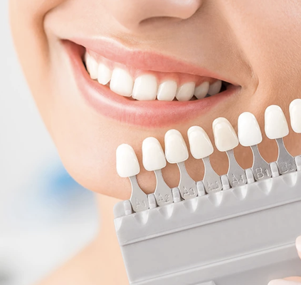 Veneers - Contact our office to schedule your consultation today! Veneers - Contact our office to schedule your consultation today!