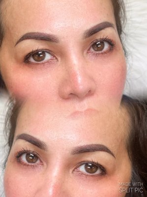 NANO OMBRE BROWS - The Ombré shading brows is a shading technique that creates an ombré appearance beginning darker at the tails of the brows and moving lighter into the center of the brows. This method uses a digital handheld machine to produce micro pixilated dots throughout the brows for a subtle, powdered in, makeup finish. Ombré Brows are ideal for all skin types, especially oily skin. This technique is recommended for anyone looking to achieve a fuller result than hairstrokes and perfect for those who want a bolder look that can totally replace makeup. The Ombré Shading brows technique lasts approximately 2-3 years before a color boost is recommended. NANO OMBRE BROWS - The Ombré shading brows is a shading technique that creates an ombré appearance beginning darker at the tails of the brows and moving lighter into the center of the brows. This method uses a digital handheld machine to produce micro pixilated dots throughout the brows for a subtle, powdered in, makeup finish. Ombré Brows are ideal for all skin types, especially oily skin. This technique is recommended for anyone looking to achieve a fuller result than hairstrokes and perfect for those who want a bolder look that can totally replace makeup. The Ombré Shading brows technique lasts approximately 2-3 years before a color boost is recommended.