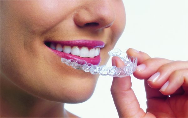 Stonebrook Dental Invisalign - Straighten your smile comfortably and discreetly with clear aligners designed to fit your lifestyle at Stonebrook Dental in Sacramento. Stonebrook Dental Invisalign - Straighten your smile comfortably and discreetly with clear aligners designed to fit your lifestyle at Stonebrook Dental in Sacramento.