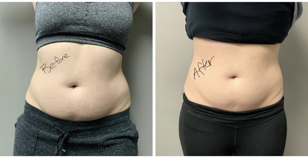 Before/After - Our actual patients showing incredible results. Before/After - Our actual patients showing incredible results.
