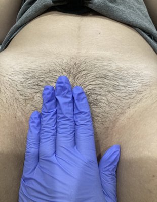 Brazilian Wax - We specialize in Brazilian wax. We take pride in expert care with beautiful results. We also offer facials, skincare, and full body waxing.
Book now for free skin consultation and first Brazilian wax discount. Brazilian Wax - We specialize in Brazilian wax. We take pride in expert care with beautiful results. We also offer facials, skincare, and full body waxing.
Book now for free skin consultation and first Brazilian wax discount.