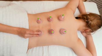 Cupping Massage - Cupping Massage