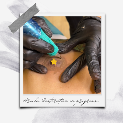 Areola Restoration - Areola tattooing is a restorative type of paramedical tattooing that involves creating hyper-realistic (3D) renderings of the nipple-areola complex (NAC). This is a permanent tattoo service for anyone who may require re-pigmentation of the area, including breast cancer survivors who have undergone mastectomies, transgender and/or non-binary clients who have had top surgery, and anyone else who may have received some form of breast surgery. For those with very little pigment naturally, this procedure can be used to achieve symmetry, balance shape, add definition, or correct color. This procedure is completely customized for each client to ensure natural-looking results.