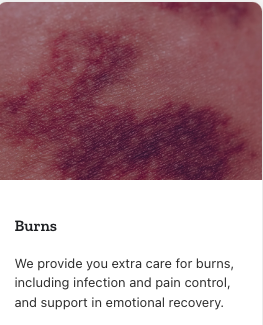 Burns - We provide you extra care for burns, including infection and pain control, and support in emotional recovery.