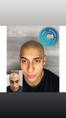 Marc’s Scalp Micro Pigmentation Journey with John Douglas at Creative Scalps Studio in Glendale Arizona. - Marc is a young Man and was loosing his hair prematurely. He sought us out to help him correct this situation he was in. We had our initial consultation and we’ve now completed his (3) treatments and he’s happy beyond words.