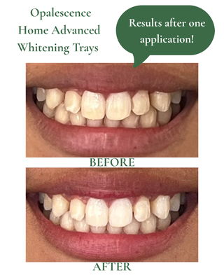 Before and After - Some of our before and after photos.