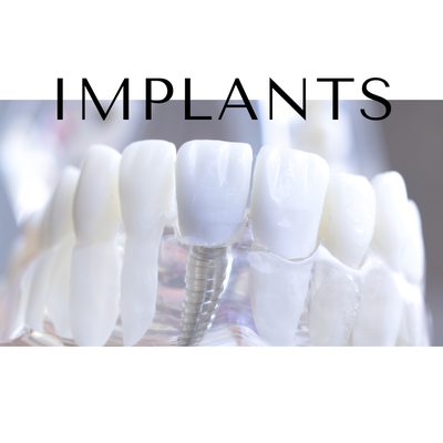 Dental Implants - Rediscover the joy of eating, speaking, and smiling with our top-quality dental implants. Our experienced dentists use cutting-edge technology to provide permanent, natural-looking tooth replacements that restore function and aesthetics. With dental implants, you can regain your confidence and enjoy life to the fullest. Embrace the future of tooth replacement with our reliable dental implant solutions.