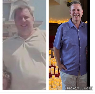 Before and After Men - Check out these amazing success stories.