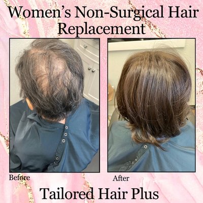 Women's non-surgical hair replacement - Tailored Hair Plus offers women a transformative solution with non-surgical hair replacement, providing a range of benefits. Firstly, it restores confidence by offering natural-looking results tailored to individual needs, seamlessly blending with existing hair. Secondly, it's a non-invasive option, eliminating the risks associated with surgical procedures. Thirdly, it provides versatility, allowing women to style their hair as desired without restrictions. Additionally, it's a convenient and time-efficient solution, with quick application processes and minimal maintenance requirements. Overall, Tailored Hair Plus empowers women to reclaim their appearance and self-assurance with a safe, effective, and customizable hair replacement solution.