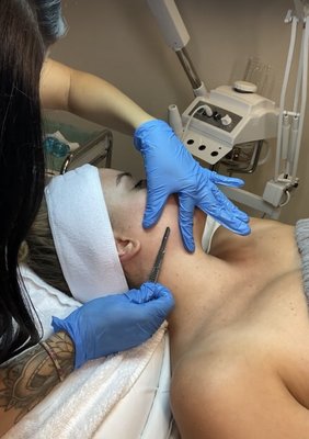Dermaplaning Facial - Dermaplaning is a simple and safe procedure for
exfoliating the epidermis and ridding the skin of fine
vellus hair (peach fuzz). This treatment may soften
fine lines and wrinkles and ease hyperpigmentation,
or uneven skin tone. It's also used to treat deep acne
scars. This Service also comes with a hydrating
HydroJelly Mask. This will immediately leave your
skin brighter and smoother. Dermaplaning Facial - Dermaplaning is a simple and safe procedure for
exfoliating the epidermis and ridding the skin of fine
vellus hair (peach fuzz). This treatment may soften
fine lines and wrinkles and ease hyperpigmentation,
or uneven skin tone. It's also used to treat deep acne
scars. This Service also comes with a hydrating
HydroJelly Mask. This will immediately leave your
skin brighter and smoother.