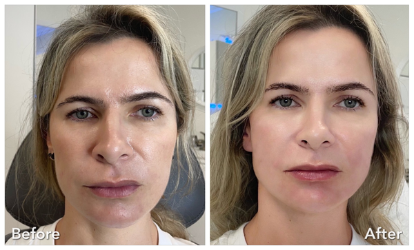 Aesthetic Excellence - Aesthetic Excellence® is unique boutique med spa clinic proud to have Livia Manner, FNP. She has established herself as one of the well respected Medical Aesthetic Nurse Practitioners in South Florida. She clearly utilizes one hundred percent of her time practicing the art of aesthetic procedures, making her one of the best practitioner in the aesthetic industry. Aesthetic Excellence - Aesthetic Excellence® is unique boutique med spa clinic proud to have Livia Manner, FNP. She has established herself as one of the well respected Medical Aesthetic Nurse Practitioners in South Florida. She clearly utilizes one hundred percent of her time practicing the art of aesthetic procedures, making her one of the best practitioner in the aesthetic industry.