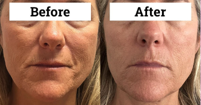 Before & After - Before & After. Customized body transformations amazing for building muscle, fat loss, and cellulite reduction. Before & After - Before & After. Customized body transformations amazing for building muscle, fat loss, and cellulite reduction.