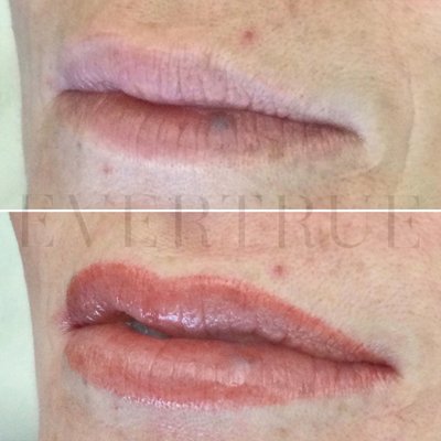 Lip Blushing - This "permanent makeup" treatment creates shape and brings a healthy, natural-looking blush to your lips. Cover blemishes or irregularities in lip color and tone, with pinks, corals, nudes, and browns that are true to life. Results last for up to two years. Lip Blushing - This "permanent makeup" treatment creates shape and brings a healthy, natural-looking blush to your lips. Cover blemishes or irregularities in lip color and tone, with pinks, corals, nudes, and browns that are true to life. Results last for up to two years.