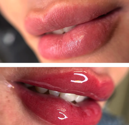 Lip Blushing - Look younger, brighter, and energized with our tattoo lip blush procedure. The treatment is quick, long-lasting, and requires zero downtime. Take a long lunch, get your lips done, and go back to work, it’s as easy as that. Lip blushing is a cosmetic tattooing procedure that uses colorful, natural pigments to enhance your lips’ natural color, shape, and definition. Also known as aquarelle lip blushing, a lip blush tattoo helps enhance your natural lip color and shape by creating the illusion of fullness. This soft tattoo technique works by adding color to the skin for a healthy flushed look. The result is a bright and youthful appearance to the lips – a velvet lip blush. The lip blush process involves minimal pain, easy healing, and no downtime. Do you want a slight reshape, more volume, the look of naturally blushed lips or a lipstick appearance? Our expert artists will make your velvet lip dreams come true. Lip Blushing - Look younger, brighter, and energized with our tattoo lip blush procedure. The treatment is quick, long-lasting, and requires zero downtime. Take a long lunch, get your lips done, and go back to work, it’s as easy as that. Lip blushing is a cosmetic tattooing procedure that uses colorful, natural pigments to enhance your lips’ natural color, shape, and definition. Also known as aquarelle lip blushing, a lip blush tattoo helps enhance your natural lip color and shape by creating the illusion of fullness. This soft tattoo technique works by adding color to the skin for a healthy flushed look. The result is a bright and youthful appearance to the lips – a velvet lip blush. The lip blush process involves minimal pain, easy healing, and no downtime. Do you want a slight reshape, more volume, the look of naturally blushed lips or a lipstick appearance? Our expert artists will make your velvet lip dreams come true.