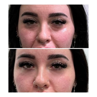 Eye Filler - Instant Results Eye Filler - Instant Results
