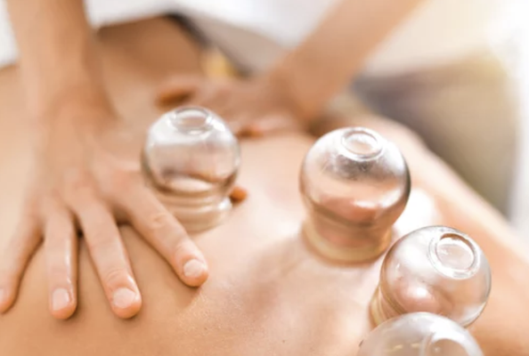 Cupping Treatment - Cupping therapy is an ancient practice that involves placing suction cups on the body. Our expert acupuncturists use time-tested techniques to promote wellness and balance. Book an appointment now! (415) 939-2777