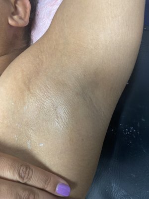 Body Waxing - Full Body Waxing Available.
Reducing ingrown hair and Razor Bumps.