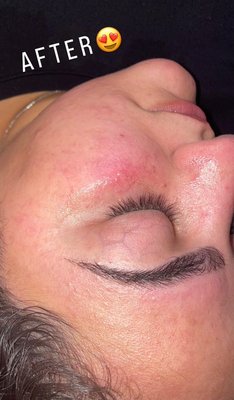 Facials - Guaranteed immediate results from the SKN lounge! Top rated facials and skincare routines for ultimate clear,glowy skin. Facials - Guaranteed immediate results from the SKN lounge! Top rated facials and skincare routines for ultimate clear,glowy skin.