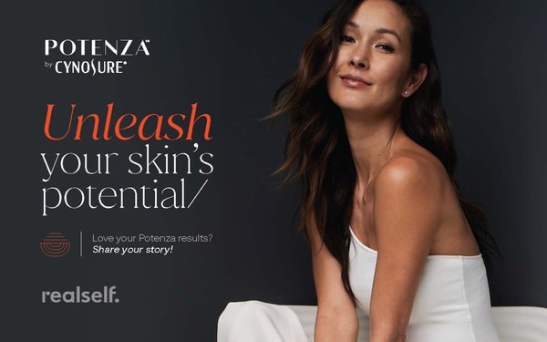 Potenza RF Microneedling - Potenza RF Microneedling with Tiger Tip technology is designed to help tighten and firm skin, reduce fine lines and wrinkles, improve skin texture, shrink pores and diminish scars on both the face and other parts of the body, resulting in younger looking skin.