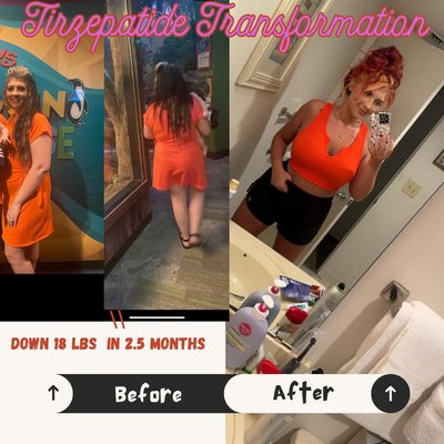 Semaglutide and Tirzepatide Transformation - GLP 1 agonists are not just for cosmetic purposes. Your labs and overall health will improve. Weight loss improves insulin resistance, A1c, Cholesterol, and overall confidence. Love yourself again with the help of injectable weight loss medications. Semaglutide and Tirzepatide Transformation - GLP 1 agonists are not just for cosmetic purposes. Your labs and overall health will improve. Weight loss improves insulin resistance, A1c, Cholesterol, and overall confidence. Love yourself again with the help of injectable weight loss medications.