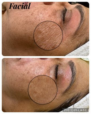 Face Threading/Waxing, Brows Lamination,Lash Lift,Body Waxing , Facials and many more. - At EZ Threads, we take pride in our exceptional brow threading, Waxing, and facial services portfolio. Our skilled experts craft perfect arches and enhance your natural beauty through precision threading techniques. Our rejuvenating facials, tailored to your unique skin needs, ensure a radiant, glowing complexion. Discover your true beauty potential with us.