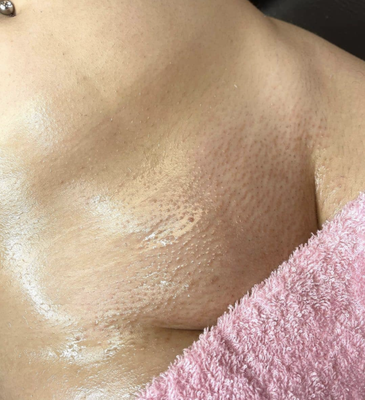 Brazilian wax - Brazilian wax done by Betty.