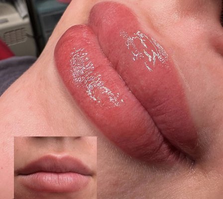 Lip blushing - Lip Blushing Is the Newest Technique for Full, Youthful Lips That Require No Maintenance. … We can define the lips a lot more and give them overall a prettier tone, which gives them a more plump and fuller look. It also helps evening out the vermilion boarder of the lips to fix any small asymmetry you may have.
The technique and color choices I make create a natural, blushed or “just bitten” look to the lips. The technique uses a small needle and works softly on the lips to very gently implant the color without creating too heavy of a lip-liner/border appearance. My overall goal is to give your lips LIFE life without being too dramatic. Lip blushing - Lip Blushing Is the Newest Technique for Full, Youthful Lips That Require No Maintenance. … We can define the lips a lot more and give them overall a prettier tone, which gives them a more plump and fuller look. It also helps evening out the vermilion boarder of the lips to fix any small asymmetry you may have.
The technique and color choices I make create a natural, blushed or “just bitten” look to the lips. The technique uses a small needle and works softly on the lips to very gently implant the color without creating too heavy of a lip-liner/border appearance. My overall goal is to give your lips LIFE life without being too dramatic.