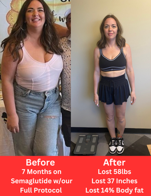Before and After - Check out a few of our before and after pictures of your clients who have been using the semaglutide and tirzepatide. Call now for a free consultation to see if its the right fit for you. Before and After - Check out a few of our before and after pictures of your clients who have been using the semaglutide and tirzepatide. Call now for a free consultation to see if its the right fit for you.