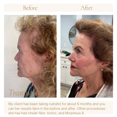improving hair loss - By healing your gut, you will heal your hair and skin. At Cox Medical Aesthetics, a medical consultation is performed to see what services can be offered to enhance your natural beauty.