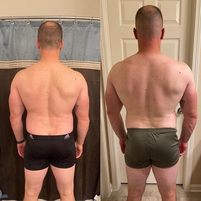 Before & Afters - Check out our before & after photo gallery. Real people, real results. Before & Afters - Check out our before & after photo gallery. Real people, real results.