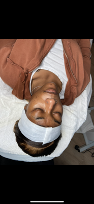 Dark Spot Correction - Before: In this photo, our client struggles with dark spots and uneven skin tone, which are common concerns from sun exposure and past breakouts.

After: Here, you can see the remarkable transformation—her skin is now clear, radiant, and even-toned, with the dark spots significantly faded, thanks to our targeted skincare treatments.