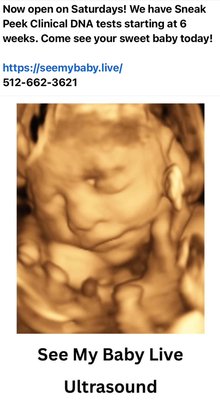 Prenatal Ultrasound - See My Baby Live offers a unique opportunity to expectant mothers.  Schedule an appointment in our gorgeous viewing studio in South Austin or hire us to come to you! We are a local ultrasound company that specializes in Obstetric ultrasounds, specifically 2D, 3D, 4D, and 5D/HD imaging. We provide a bonding experience which can be shared with the entire family and special friends. When we go mobile, we bring our machine and experience to you so that within the comfort of your own home you are able to see your little baby.  We also love events! Schedule us to come to your baby shower or sprinkle!

Click the Button to schedule your appointment today!