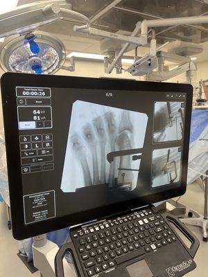 Podiatric X-rays - X-rays and wound care. Podiatric X-rays - X-rays and wound care.