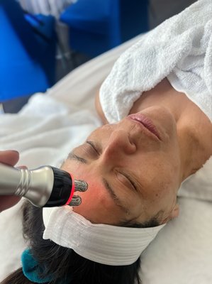 Radio frequency facial - Radio frequency skin tightening