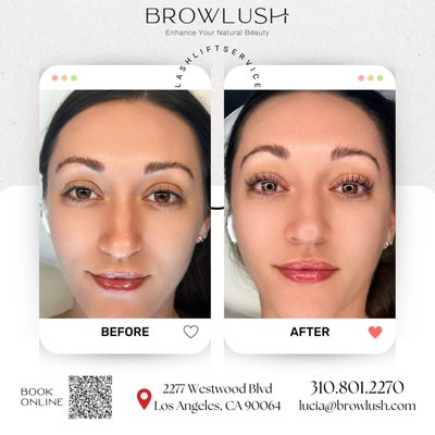 Before and After Gallery - We are here to make you look good and feel good. Seeing the results you desire in the mirror is within reach! Schedule your free consultation with Browlush.com of Los Angeles. See before and after photos of patients who have received Lip Blushing services, and lash extension from Browlush. Before and After Gallery - We are here to make you look good and feel good. Seeing the results you desire in the mirror is within reach! Schedule your free consultation with Browlush.com of Los Angeles. See before and after photos of patients who have received Lip Blushing services, and lash extension from Browlush.