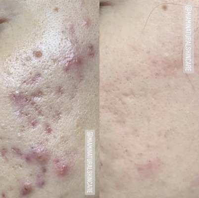 Before/After - Result oriented treatments! Before/After - Result oriented treatments!