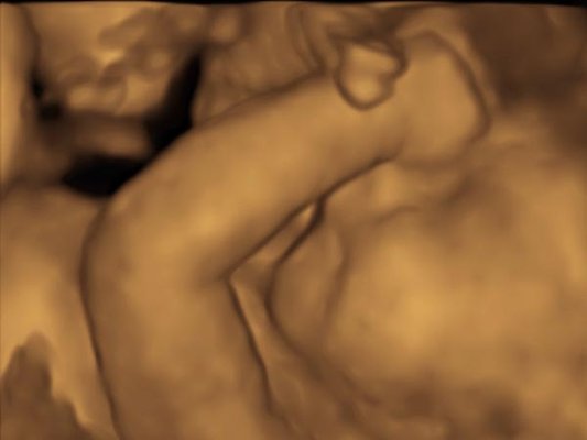 3D ultrasound - We Provide Maternity Photoshoot + Maternity ultrasound imaging + New born Photoshoot