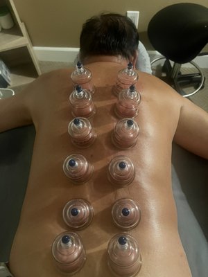 Deep tissue Massage - Recommend add on Cupping Deep tissue Massage - Recommend add on Cupping