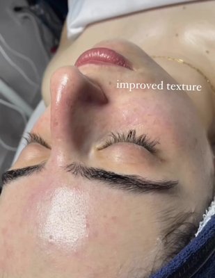 Facials - Lie back and relax as a skin specialist cleanses, exfoliates and hydrates your skin.