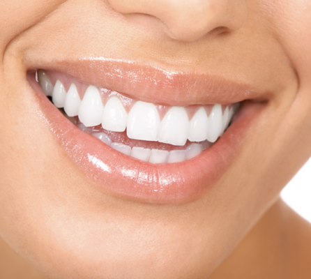 Teeth Whitening - WHITER TEETH. MINIMAL SENSITIVITY. MAXIMUM COMFORT.
Our in-office teeth whitening is a relaxing, one-hour experience designed to gently lift stains while preserving your enamel. You can unwind with AirPods Max, your favorite Netflix show or music, and leave with a noticeably brighter smile.
Most patients see an improvement of 2 to 3 shades after just one session.
Before whitening, we often recommend a professional cleaning to remove surface buildup and ensure even results. Teeth Whitening - WHITER TEETH. MINIMAL SENSITIVITY. MAXIMUM COMFORT.
Our in-office teeth whitening is a relaxing, one-hour experience designed to gently lift stains while preserving your enamel. You can unwind with AirPods Max, your favorite Netflix show or music, and leave with a noticeably brighter smile.
Most patients see an improvement of 2 to 3 shades after just one session.
Before whitening, we often recommend a professional cleaning to remove surface buildup and ensure even results.