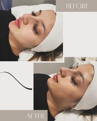 Skin Treatments - Contact us for your complimentary consultation and let us customize your wellness plan and create the confidence you deserve. Skin Treatments - Contact us for your complimentary consultation and let us customize your wellness plan and create the confidence you deserve.