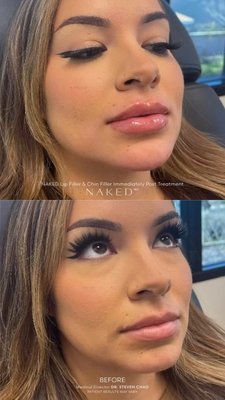 Facial Balancing - Facial Balancing Facial Balancing - Facial Balancing