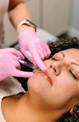 Botox, Dysport, Sculptra, and Dermal Filler - Pure Aesthetics offers a variety of injectable services. From BOTOX and Dysport to dermal fillers such as Juvederm, Revanesse and Restylane. Pure Aesthetics also offers Sculptra to help replace collagen that is lost as you age, Kybella to reduce the appearance of a double chin, and PDO thread lifts which are used to lift, tighten, firm and smooth your skin.
