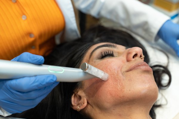Microneedling - Boost collagen, smooth texture, and reveal brighter, firmer skin with our professional microneedling treatment. This service improves fine lines, acne scars, pores, and overall tone. Microneedling - Boost collagen, smooth texture, and reveal brighter, firmer skin with our professional microneedling treatment. This service improves fine lines, acne scars, pores, and overall tone.