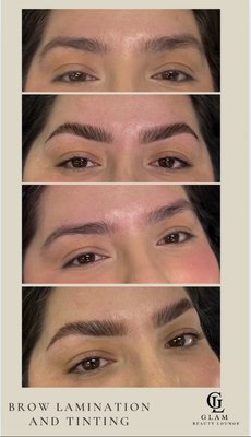Brow Lamination, Last lift and tinting - Enhance your natural beauty with our signature brow and lash services.
We offer Brow Lamination, Lash Lift, and Tinting to give you fuller brows, lifted lashes, and a darker, more defined look—all with zero daily maintenance.
• Brow Lamination – Smooth, lifted, and fuller-looking brows that stay in place for weeks.
• Lash Lift – A natural curl that opens up your eyes without extensions.
• Tinting – Darker, bolder brow and lashes for a mascara-like effect that lasts.
Perfect for clients who want a polished, effortless look every day.
Book your beauty upgrade at Glam and wake up feeling confident and camera-ready. Brow Lamination, Last lift and tinting - Enhance your natural beauty with our signature brow and lash services.
We offer Brow Lamination, Lash Lift, and Tinting to give you fuller brows, lifted lashes, and a darker, more defined look—all with zero daily maintenance.
• Brow Lamination – Smooth, lifted, and fuller-looking brows that stay in place for weeks.
• Lash Lift – A natural curl that opens up your eyes without extensions.
• Tinting – Darker, bolder brow and lashes for a mascara-like effect that lasts.
Perfect for clients who want a polished, effortless look every day.
Book your beauty upgrade at Glam and wake up feeling confident and camera-ready.