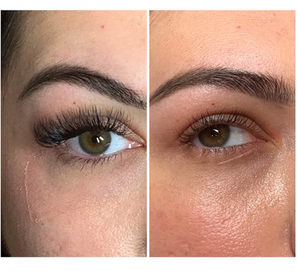 Before And After - Before And After Before And After - Before And After
